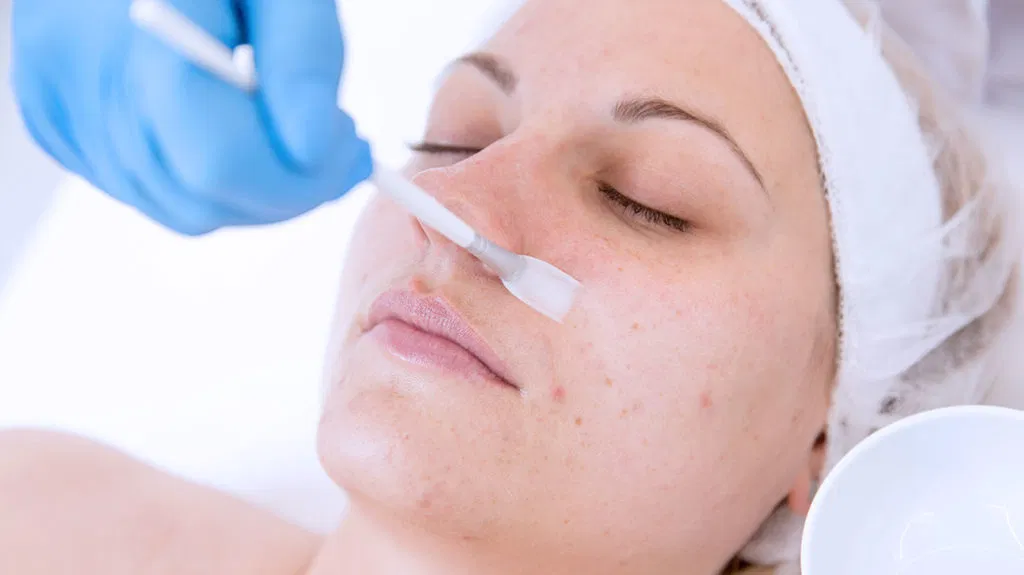 What to Do Before a Chemical Peel